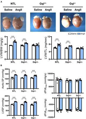 Cardiac Gq Receptors and Calcineurin Activation Are Not Required for the Hypertrophic Response to Mechanical Left Ventricular Pressure Overload